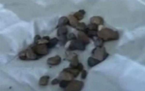 بالفيديو.. فتاة يمنية تبكى أحجارا سوداء بدل الدموع